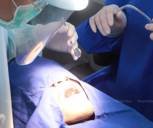Đi nhổ 12 chiếc răng sâu, người đàn ông chết oan uổng vì không được cầm máu