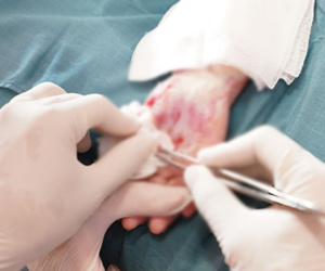 Nghịch máy chạy bộ tại nhà, 3 trẻ nhỏ phải cấp cứu vì bỏng nặng