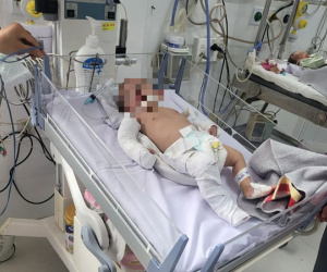 5 lần bị bạo hành dã man khiến bé gái 2 tháng tuổi chấn thương sọ não, gãy đa xương