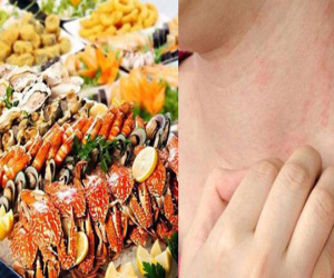 Một người bất ngờ tử vong sau khi ăn cua biển, cần làm gì để phòng ngừa ngộ độc hải sản?