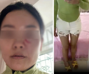 Bố chồng hắt canh nóng, cào mặt con dâu chỉ vì một lý do 'lãng xẹt', dân mạng phẫn nộ