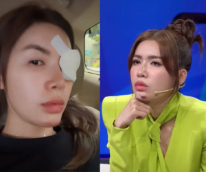 Minh Tú tiếp tục gặp vấn đề sức khỏe sau sự cố phải khâu 10 mũi ở cằm
