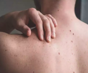 Biến chứng đáng sợ của loại ung thư tưởng 'lành nhất'