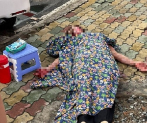 Truy tìm kẻ đổ xăng lên người tình, dùng dao rạch mặt