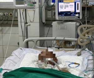 Bị gạch rơi vào ngón chân, nam thanh niên phải thở máy điều trị uốn ván