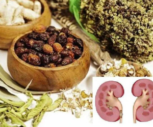 Suýt mất quả thận vì tự ý điều trị sỏi thận bằng thuốc đông y
