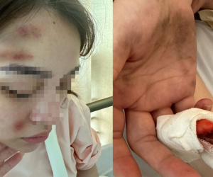 Một cảnh sát hình sự bị bạn gái 'tố' hành hung gây thương tích