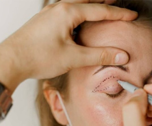 Người phụ nữ bị sót chỉ khâu trên mặt sau khi làm đẹp hết 60 triệu đồng