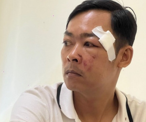Người đàn ông vừa rời trụ sở Tòa án thì bị anh họ hành hung, 'rạch mặt'