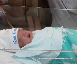 Nuôi sống bé trai Hà Nội sinh non 25 tuần nặng 600 gram, hồ sơ bệnh án nặng hơn nhiều lần cơ thể