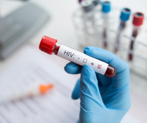 Đi làm móng nhiễm HIV: Bác sĩ nói gì?
