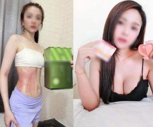 Top 5 biện pháp làm đẹp không khoa học tràn lan MXH, chị em học theo dễ 'tiền mất tật mang'