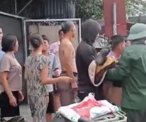 Xin tiền không được, con tưới xăng đốt nhà khiến mẹ bỏng nặng