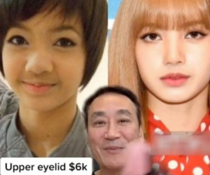 Bác sĩ khẳng định BlackPink phẫu thuật thẩm mỹ nhiều