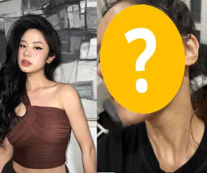 'Nữ thần mạng' bất ngờ khi công khai ảnh gương mặt trong tình trạng chưa ai từng thấy