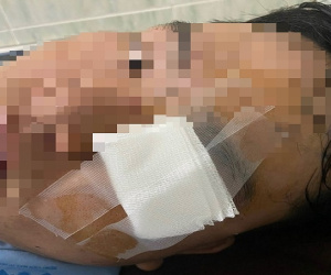 Nam thanh niên nhập viện vì 'va vào gậy của CSGT' nói gì?