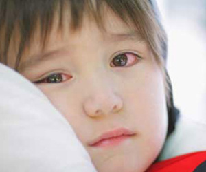 Cảnh báo: Hàng loạt trẻ ở Hà Nội bị đau mắt đỏ có biến chứng phải nhập viện