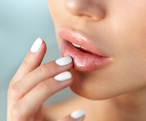 Cách loại bỏ đôi môi nứt nẻ trong mùa đông