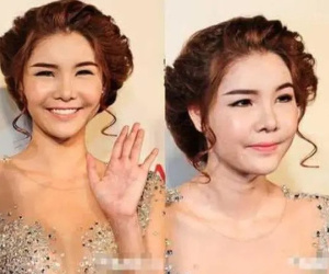 Siêu mẫu Kỳ Hân - vợ Mạc Hồng Quân tiết lộ khủng hoảng vì khuôn mặt biến dạng sau phẫu thuật thẩm mỹ