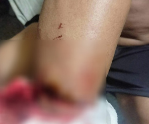Bắt giữ 2 nghi phạm cướp tài sản rồi kêu bị hại... nấu mì gói cho ăn