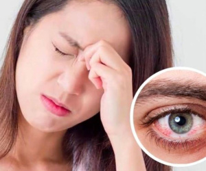 Giải đáp câu hỏi: Nhìn nhau có lây bệnh đau mắt đỏ không?