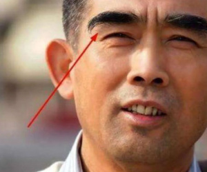 60 tuổi thấy lông mày mọc dài thì mừng vội, cứ tưởng dấu hiệu trường thọ, không ngờ bác sĩ lắc đầu thở dài