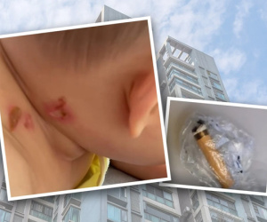Bé gái 4 tuổi bị thương khiến cảnh sát yêu cầu toàn bộ người dân trong khu chung cư đi xét nghiệm ADN