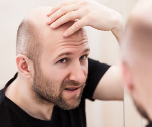 5 cách mọc tóc nhanh cho nam tại nhà siêu đơn giản