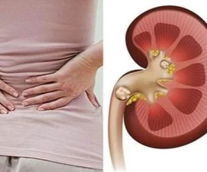 Thói quen tưởng vô hại nhưng lại là nguyên nhân khiến thận chứa cả 'túi sỏi'