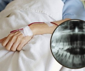 Nam sinh 16 tuổi bị viêm lợi cấp, vào viện mới phát hiện mắc ung thư máu