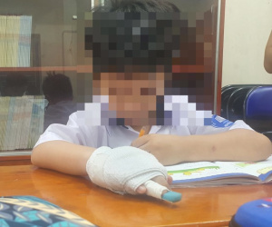 Xử lý nghiêm giáo viên tác động vật lý làm học sinh gãy ngón tay