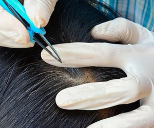 Vì sao không nên nhổ tóc bạc?