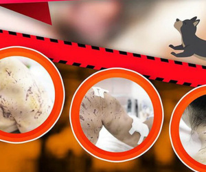 Bé gái 7 tuổi bị 4 con chó lao vào cắn, để lại hàng trăm vết thương