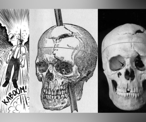 Người đàn ông bị thanh sắt đâm xuyên đầu vẫn sống khỏe nhưng đổi hoàn toàn nhân cách, bí mật khám phá sau đó tạo nên cách mạng ngành y