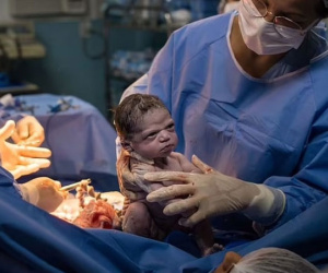Cuộc sống hiện tại của em bé nổi tiếng khắp thế giới vì lườm bác sĩ lúc chào đời