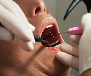 Lao công mạo danh nha sĩ nhổ nhiều răng của bệnh nhân