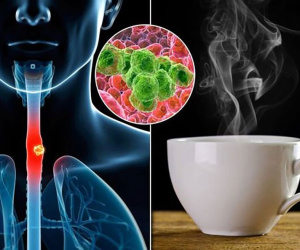 Tiến sĩ Anh cảnh báo loại đồ uống có thể làm tăng 79% nguy cơ mắc ung thư, mùa đông nên cẩn trọng