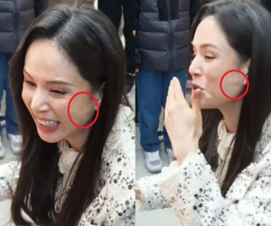 'Tiểu Long Nữ' Lý Nhược Đồng bị nghi vấn 'dao kéo' vì 1 chi tiết lạ trên mặt, nhưng sự thật lại đáng xót xa