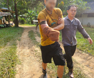 Làm việc trong khu bảo tồn, người thanh niên phải chặt tay khi bị gấu tấn công