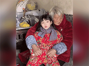 Cô bé "gây bão" nhờ gương mặt tựa thiên thần, nhưng ít ai biết được phía sau nhan sắc ấy là căn bệnh hiếm gặp
