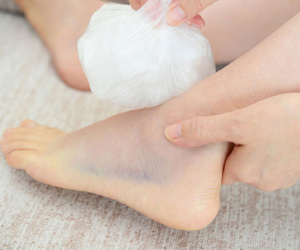 Ngại đi khám, người phụ nữ phải cắt 2 chân vì 'bệnh vặt'