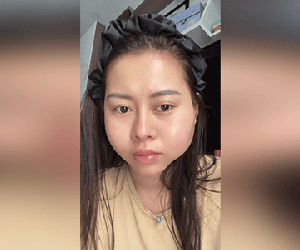 Việt Phương Thoa biến chứng thẩm mỹ sau 6 năm: Bị lừa bơm silicon lên mặt, tình trạng hiện tại thế nào?