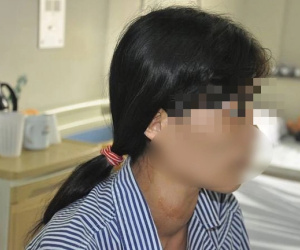 Suýt mất mạng chỉ vì một thói quen mà rất nhiều người Việt đang mắc