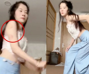 Nam Em tự đăng clip tập nhảy với biểu hiện bất ổn, loạt vết bầm trên tay gây chú ý