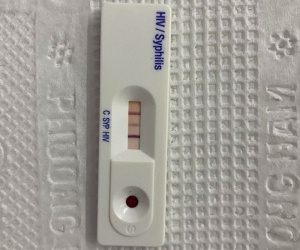 Nhiễm cùng lúc HIV và giang mai chỉ sau 1 lần 'quan hệ' không nhớ có dùng 'biện pháp bảo vệ' hay không