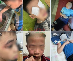 Ảnh bìa bài viết 929614