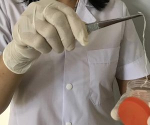 Kéo từ đùi ra một 'sợi dây' màu trắng dài cả chục cm, người đàn ông đi khám, giật mình vì nguyên nhân