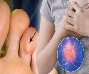 3 dấu hiệu đáng kinh ngạc ở chân cảnh báo một căn bệnh giết người thầm lặng