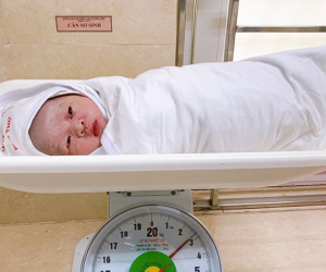 Em bé chào đời với dây rốn quấn cổ 5 vòng hiếm gặp