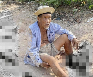 Điều tra vụ cụ ông 85 tuổi bị dập nát 2 bàn chân